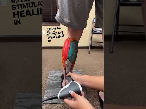 Revitalize Your Recovery: Smart Solutions for Calf Strain Care