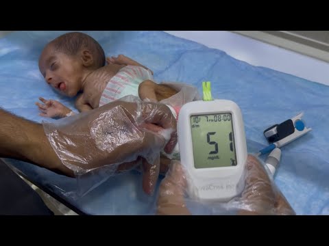 Smart Solutions for Managing Low Sugar in Newborns
