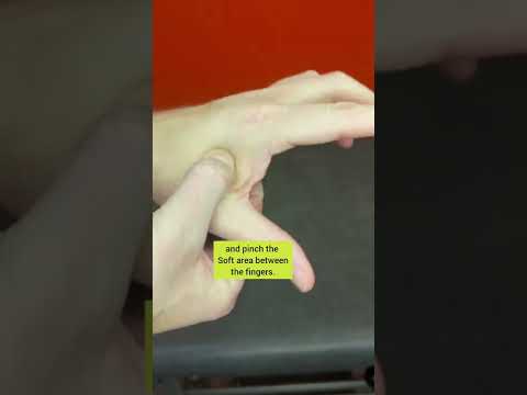 Healing Hands: The Benefits of Trapeziectomy for Pain Relief