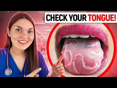 Tongue Health: Understanding STDs and Their Signs