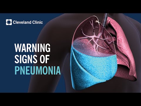 Spotting Pneumonia in Dogs: Key Signs Every Owner Should Know