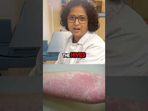 Zyrtec Antihistamine: Smart Relief at Your Fingertips
