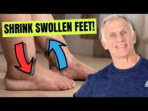 Swollen Feet Solutions: Tech Innovations for Relief