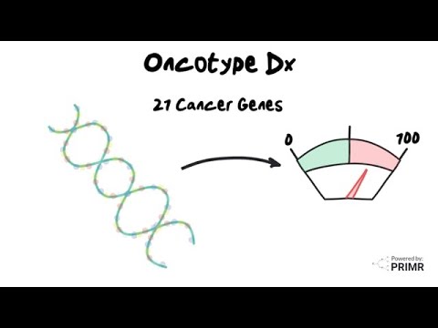 Oncotype DX: Revolutionizing Personal Cancer Treatment