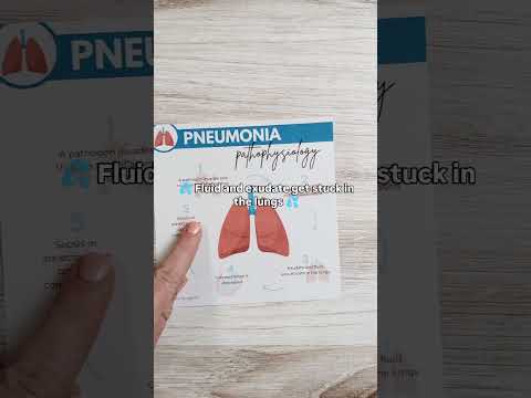 Unraveling Pneumonia's Pathophysiology Through Innovation