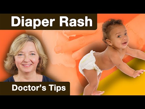 Top Tech Solutions for Effective Diaper Rash Relief
