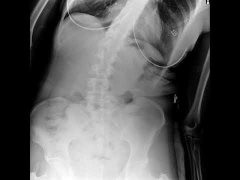 Revitalize Your Health with Advanced L Spine X-Ray Technology