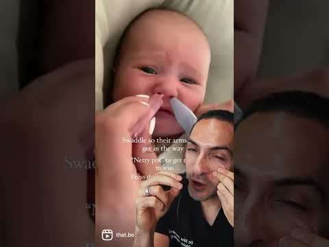 Breathe Easy: Smart Solutions for Infant Stuffy Nose Relief