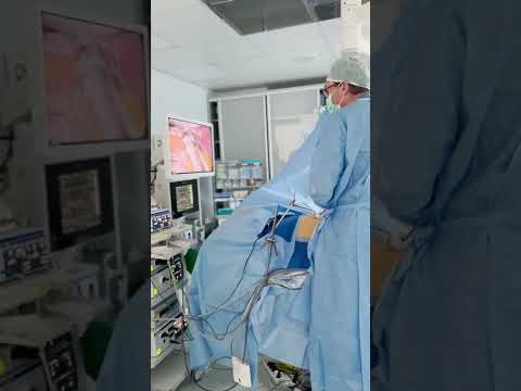 Revolutionizing Stomach Surgery with Cutting-Edge Tech