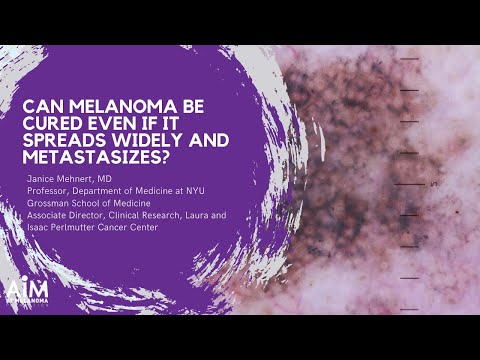 Innovative Solutions for Late Stage Melanoma Management
