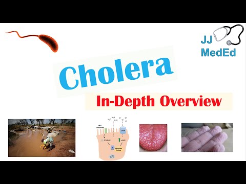 Cholera Explained: A Critical Look at Its Definition and Impact