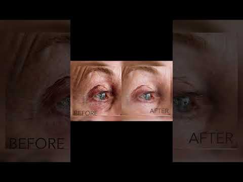 Revitalize Your Eyes with Strivectin's Innovative Cream