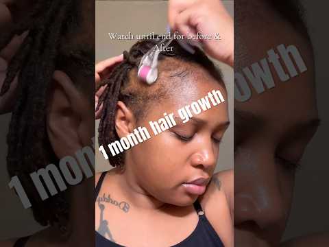 Revitalize Your Hair with Cutting-Edge Keranique Solutions