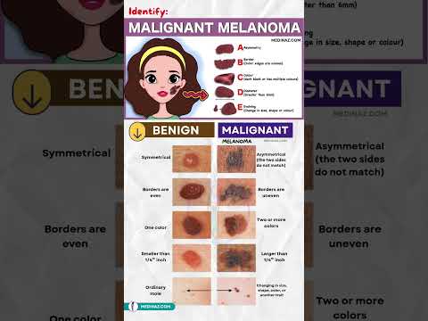 Unlocking the Secrets of Melanoma Cancer Variants