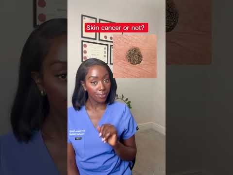 Stay Aware: Advanced Tech in Malignant Melanoma Foot Care