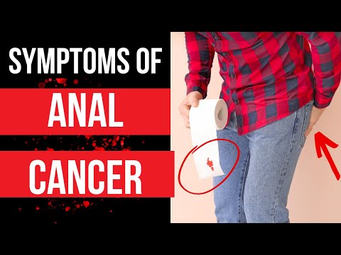 Innovative Solutions for Managing Itchy Anus Cancer Symptoms